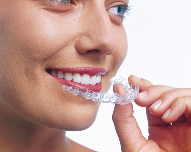 Consigue los dientes perfectos con la ortodoncia de invisalign en clínica dental Corral y Vargas, Granada