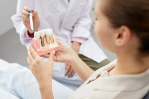 Rechazo a los implantes dentales - Todo lo que debes saber