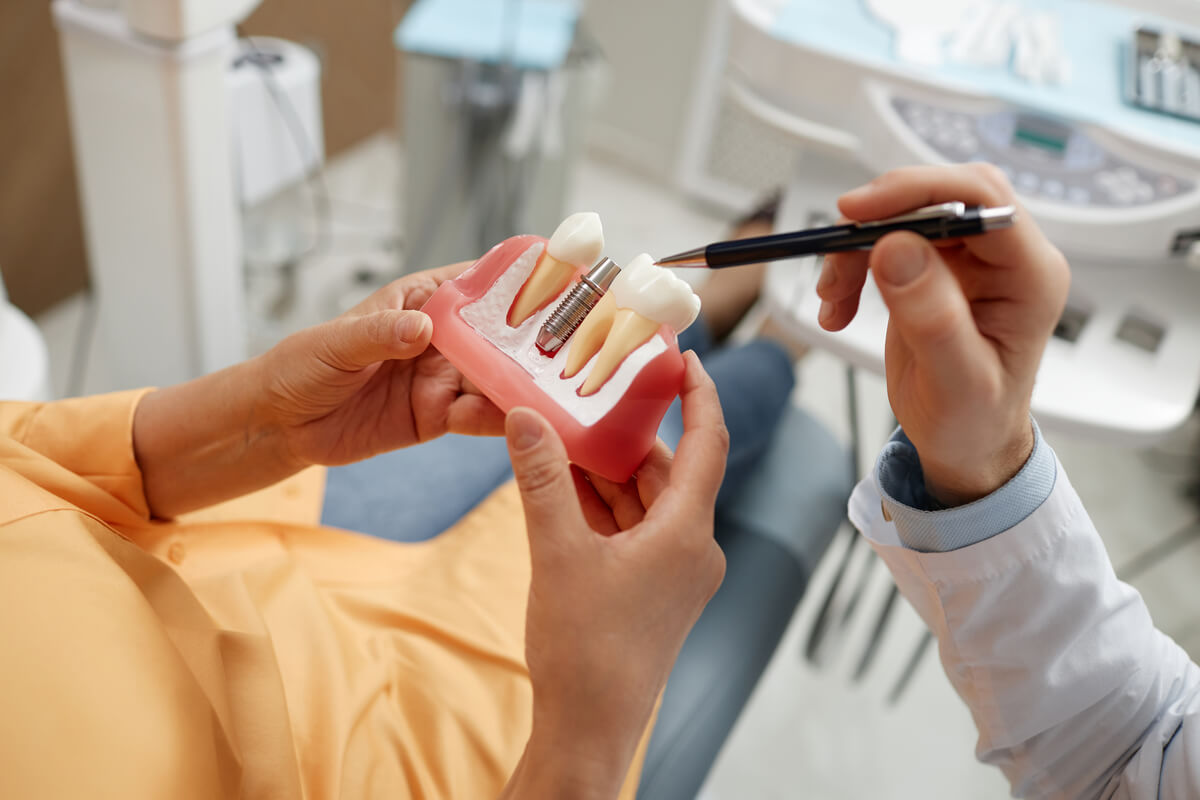 ¿Son posibles los implantes dentales sin tornillos